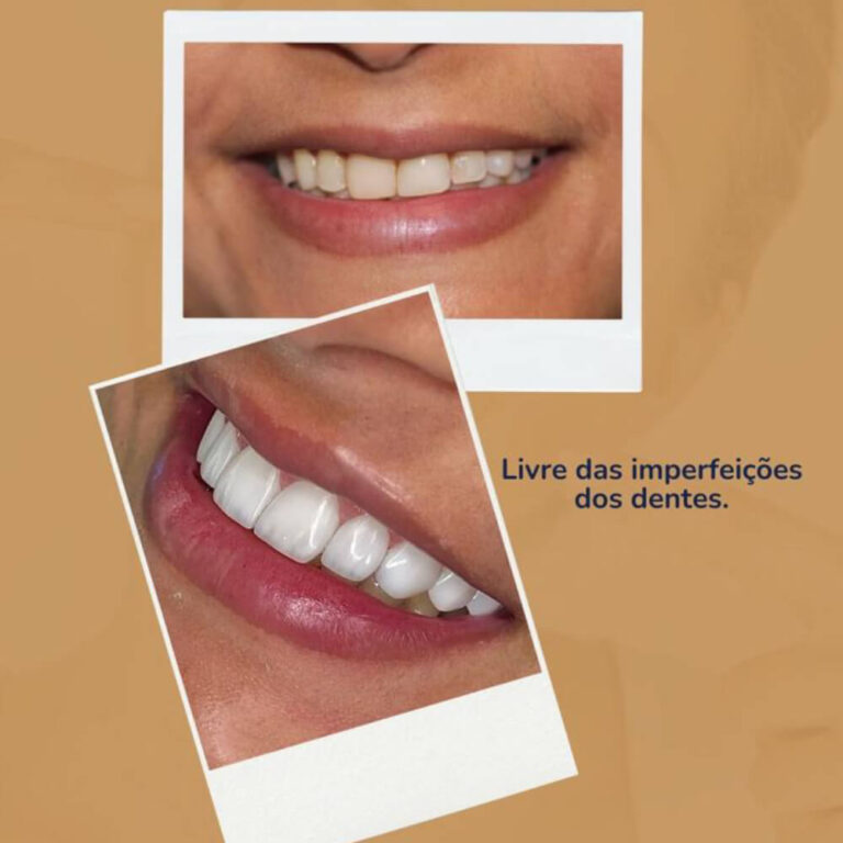 Estética Dental petrolina pe